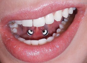 Tongue web Piercing Stoke-on-trent Body piercing - Hanley, ear, Newcastle, stafffordshire