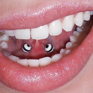 Tongue web Piercing Stoke-on-trent Body piercing - Hanley, ear, Newcastle, stafffordshire